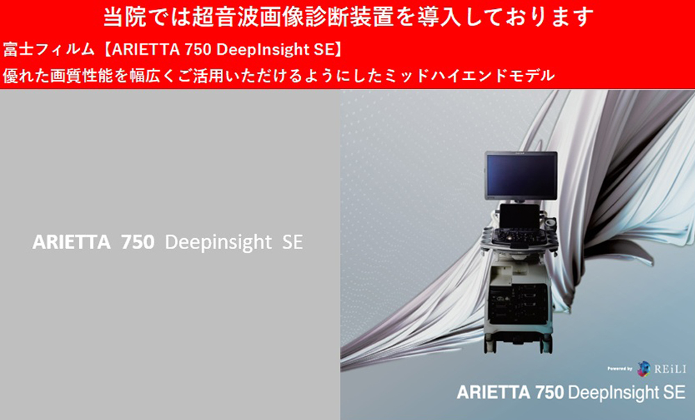 超音波診断装置